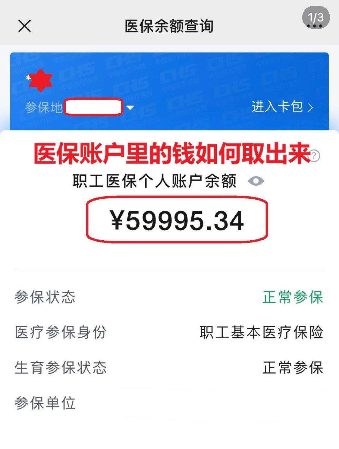 江津为什么医保卡里没有钱(为什么医保卡里没有钱还可以报销)