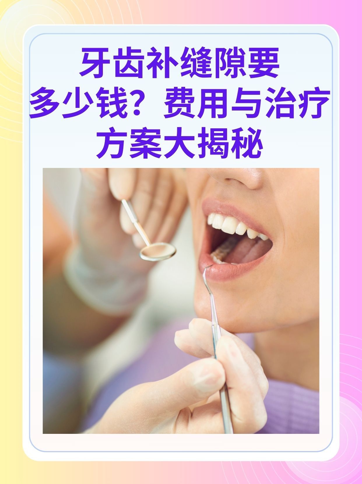 江津补牙医保可以报销吗(补牙医保可以报销吗 哪些可以报销呢)